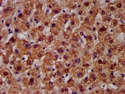 Invitrogen CPS1 Polyclonal Antibody 100 &mu;g; Unconjugated:Antibodies,
