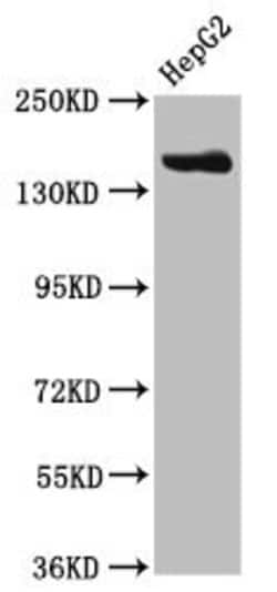 Invitrogen CPS1 Polyclonal Antibody 100 &mu;g; Unconjugated:Antibodies,
