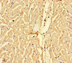 Invitrogen CPT1A Polyclonal Antibody 100 &mu;g; Unconjugated:Antibodies,