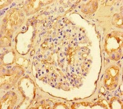 Invitrogen CPT1A Polyclonal Antibody 100 &mu;g; Unconjugated:Antibodies,
