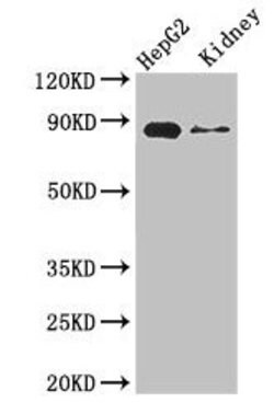 Invitrogen CPT1A Polyclonal Antibody 100 &mu;g; Unconjugated:Antibodies,