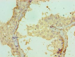 Invitrogen CRISP2 Polyclonal Antibody 100 &mu;L; Unconjugated:Antibodies,