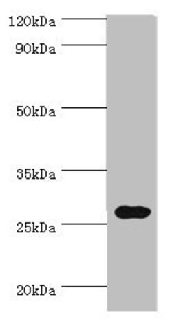 Invitrogen CRISP2 Polyclonal Antibody 100 &mu;L; Unconjugated:Antibodies,