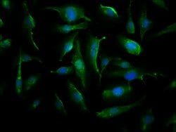 Invitrogen CRYAB Polyclonal Antibody 100 &mu;g; Unconjugated:Antibodies,