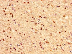 Invitrogen CRYAB Polyclonal Antibody 100 &mu;g; Unconjugated:Antibodies,