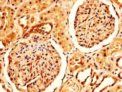 Invitrogen CRYAB Polyclonal Antibody 100 &mu;g; Unconjugated:Antibodies,