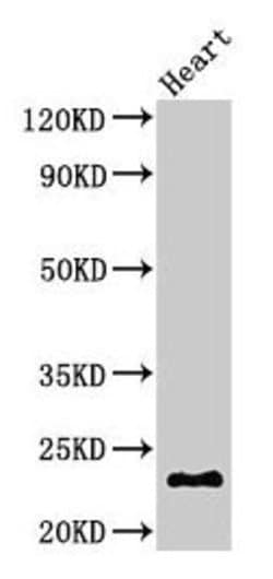 Invitrogen CRYBA4 Polyclonal Antibody 100 &mu;g; Unconjugated:Antibodies,