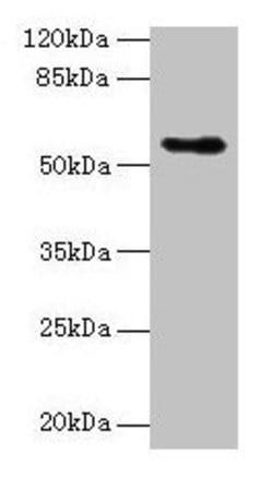 Invitrogen CSAD Polyclonal Antibody 100 &mu;g; Unconjugated:Antibodies,