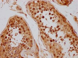 Invitrogen CAS Polyclonal Antibody 100 μL; Unconjugated:Antibodies,