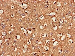 Invitrogen CSGALNACT2 Polyclonal Antibody 100 &mu;g; Unconjugated:Antibodies,
