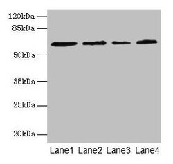 Invitrogen CSGALNACT2 Polyclonal Antibody 100 &mu;g; Unconjugated:Antibodies,