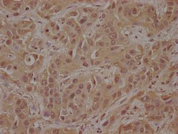 CSK Polyclonal Antibody:Antibodies, Polyclonal