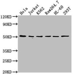 CSK Polyclonal Antibody:Antibodies, Polyclonal