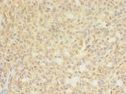 Invitrogen CTPS Polyclonal Antibody 100 &mu;g; Unconjugated:Antibodies,