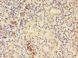 Invitrogen CTPS Polyclonal Antibody 100 &mu;g; Unconjugated:Antibodies,