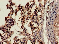 Invitrogen Cathepsin H Polyclonal Antibody 100 &mu;g | Buy Online | Invitrogen&trade; | Fisher Scientific