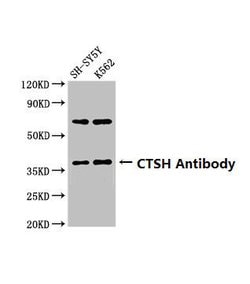 Invitrogen Cathepsin H Polyclonal Antibody 100 &mu;g | Buy Online | Invitrogen&trade; | Fisher Scientific