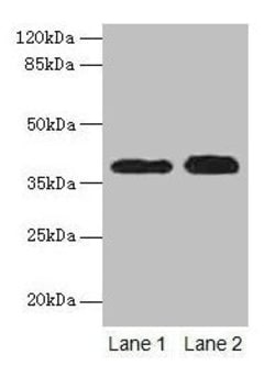 Invitrogen Cathepsin L Polyclonal Antibody 100 &mu;g; Unconjugated:Antibodies,