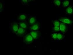 Invitrogen CUG-BP2 Polyclonal Antibody 100 &mu;g; Unconjugated:Antibodies,