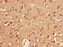 Invitrogen CUG-BP2 Polyclonal Antibody 100 &mu;g; Unconjugated:Antibodies,