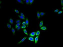 Invitrogen CYB5B Polyclonal Antibody 100 &mu;g | Buy Online | Invitrogen&trade; | Fisher Scientific