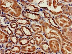 Invitrogen CYB5B Polyclonal Antibody 100 &mu;g | Buy Online | Invitrogen&trade; | Fisher Scientific