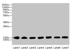 Invitrogen CYB5B Polyclonal Antibody 100 &mu;g | Buy Online | Invitrogen&trade; | Fisher Scientific