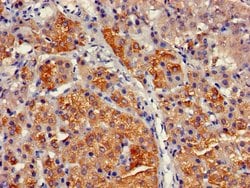 Invitrogen CYP17A1 Polyclonal Antibody 100 &mu;g | Buy Online | Invitrogen&trade; | Fisher Scientific