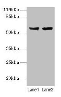 Invitrogen CYP17A1 Polyclonal Antibody 100 &mu;g | Buy Online | Invitrogen&trade; | Fisher Scientific