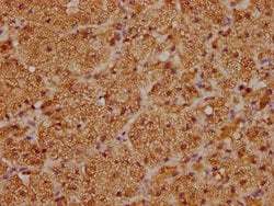 Invitrogen CYP21A2 Polyclonal Antibody 100 &mu;L | Buy Online | Invitrogen&trade; | Fisher Scientific