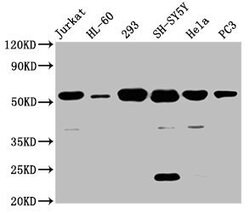 Invitrogen CYP21A2 Polyclonal Antibody 100 &mu;L | Buy Online | Invitrogen&trade; | Fisher Scientific