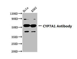 Invitrogen CYP7A1 Polyclonal Antibody 100 &mu;g; Unconjugated:Antibodies,