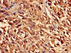 Invitrogen CYSLTR1 Polyclonal Antibody 100 &mu;g; Unconjugated:Antibodies,