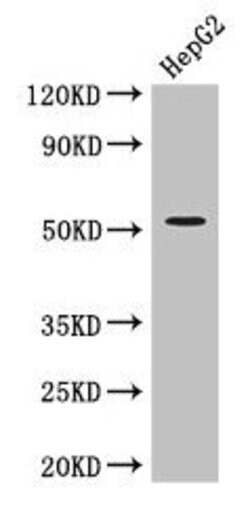 Invitrogen ZIPK Polyclonal Antibody 100 &mu;g; Unconjugated:Antibodies,