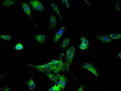 Invitrogen DDX6 Polyclonal Antibody 100 &mu;g; Unconjugated:Antibodies,