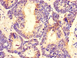 Invitrogen DDX6 Polyclonal Antibody 100 &mu;g; Unconjugated:Antibodies,