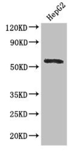 Invitrogen DDX6 Polyclonal Antibody 100 &mu;g; Unconjugated:Antibodies,