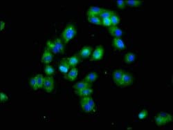 Invitrogen DLK1 Polyclonal Antibody 100 &mu;g; Unconjugated:Antibodies,