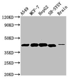 Invitrogen DLK1 Polyclonal Antibody 100 &mu;g; Unconjugated:Antibodies,