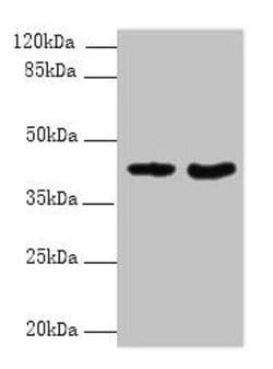 Invitrogen DMKN Polyclonal Antibody 100 &mu;g; Unconjugated:Antibodies,