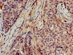 Invitrogen DNAJB2 Polyclonal Antibody 100 &mu;g; Unconjugated:Antibodies,