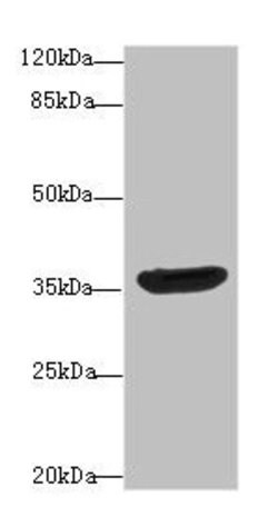 Invitrogen DNAJB2 Polyclonal Antibody 100 &mu;g; Unconjugated:Antibodies,