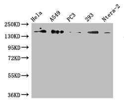 Invitrogen DUOX2 Polyclonal Antibody 100 &mu;L; Unconjugated:Antibodies,