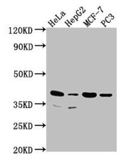 Invitrogen DUSP11 Polyclonal Antibody 100 &mu;L | Buy Online | Invitrogen&trade; | Fisher Scientific