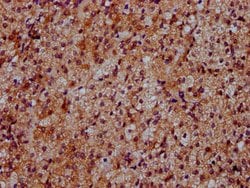 Invitrogen DYM Polyclonal Antibody 100 &mu;g | Buy Online | Invitrogen&trade; | Fisher Scientific