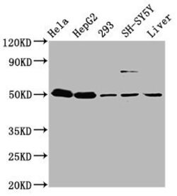 Invitrogen DYM Polyclonal Antibody 100 &mu;g | Buy Online | Invitrogen&trade; | Fisher Scientific