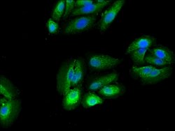 Invitrogen RPS5 Polyclonal Antibody 100 &mu;g; Unconjugated:Antibodies,