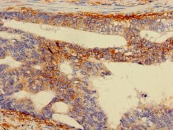 Invitrogen RPS5 Polyclonal Antibody 100 &mu;g; Unconjugated:Antibodies,