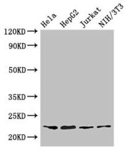 Invitrogen RPS5 Polyclonal Antibody 100 &mu;g; Unconjugated:Antibodies,