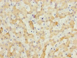 Invitrogen ECHS1 Polyclonal Antibody 100 &mu;L; Unconjugated:Antibodies,